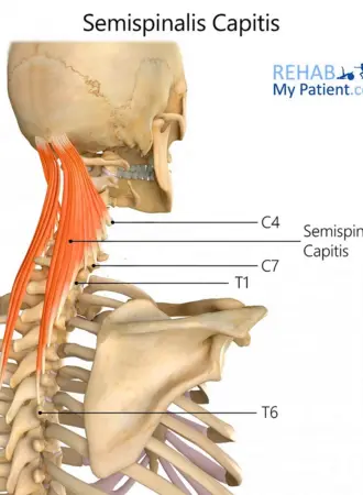 Semispinalis Cervicis